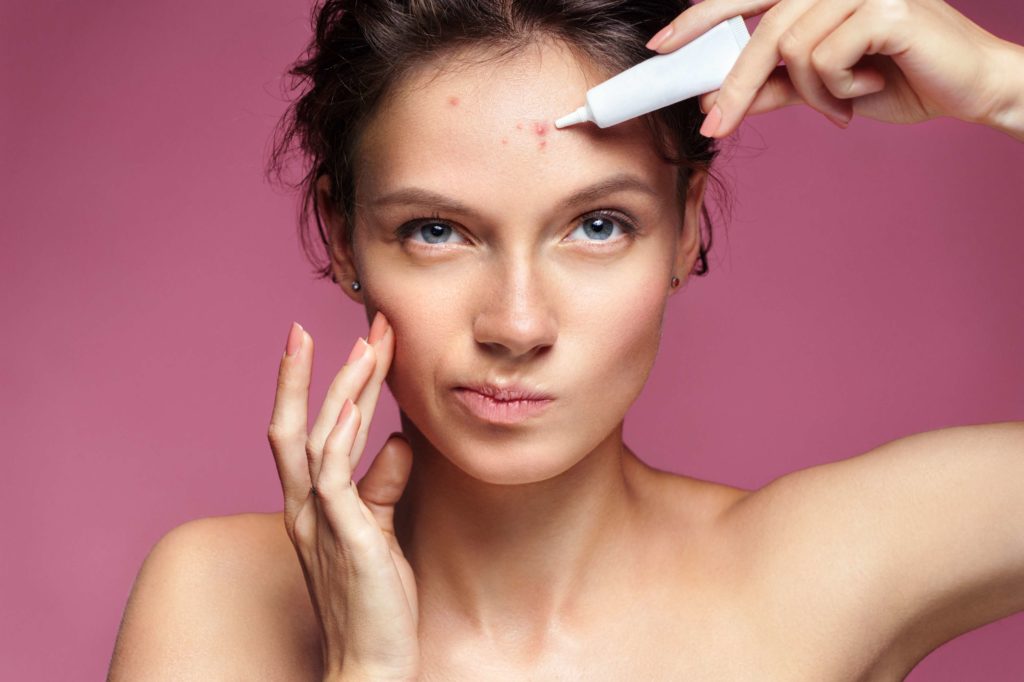 Acne Scar Management | Skynn MD in Holly Springs, NC