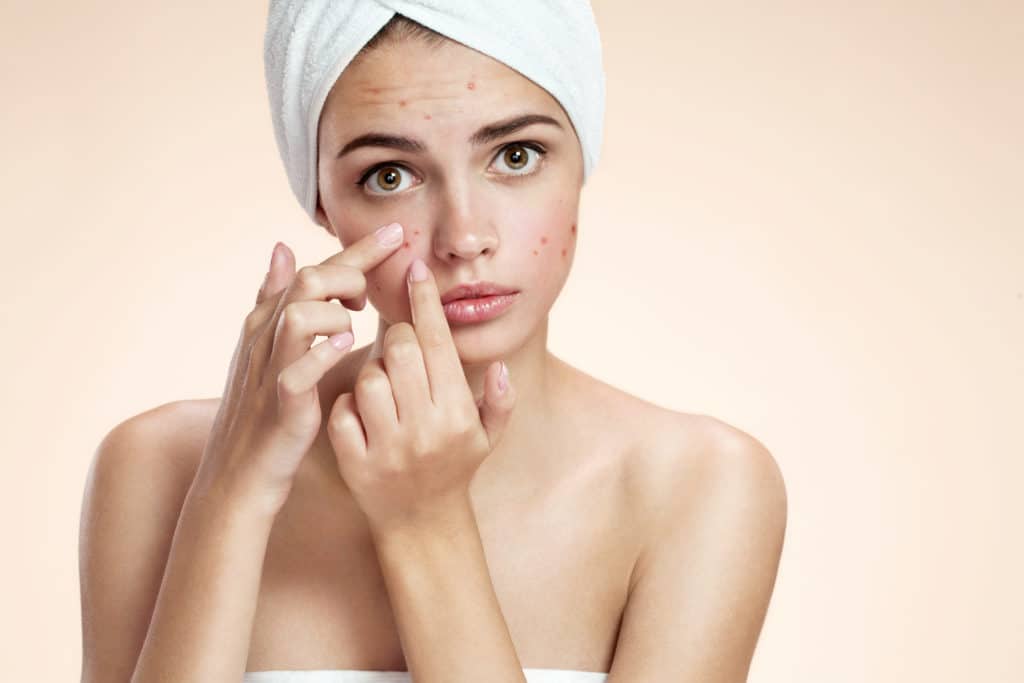 Woman Pinching Acne | Skynn MD in Holly Springs, NC