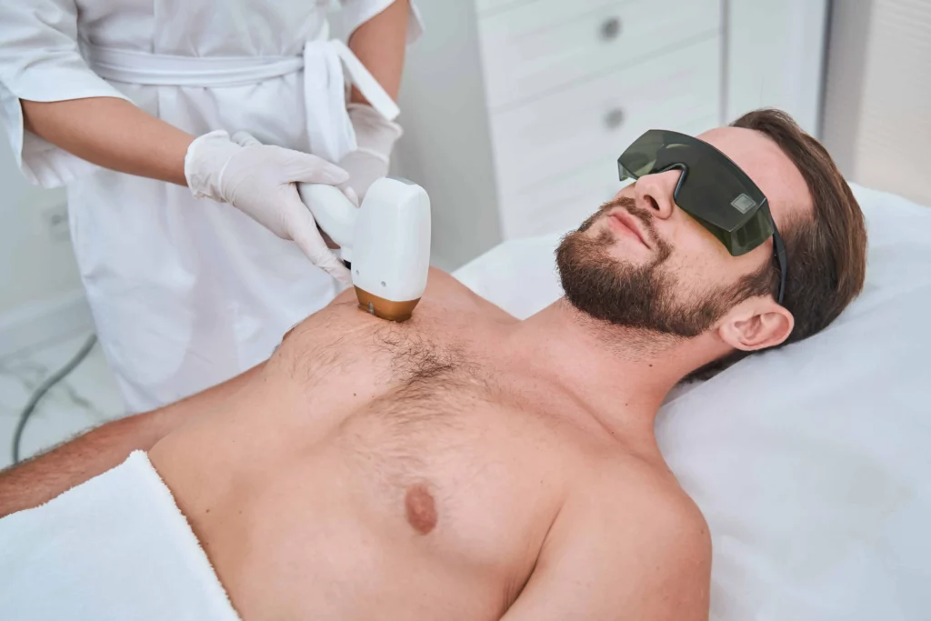 Back & Chest Laser Hair Removal Service in Holly Springs