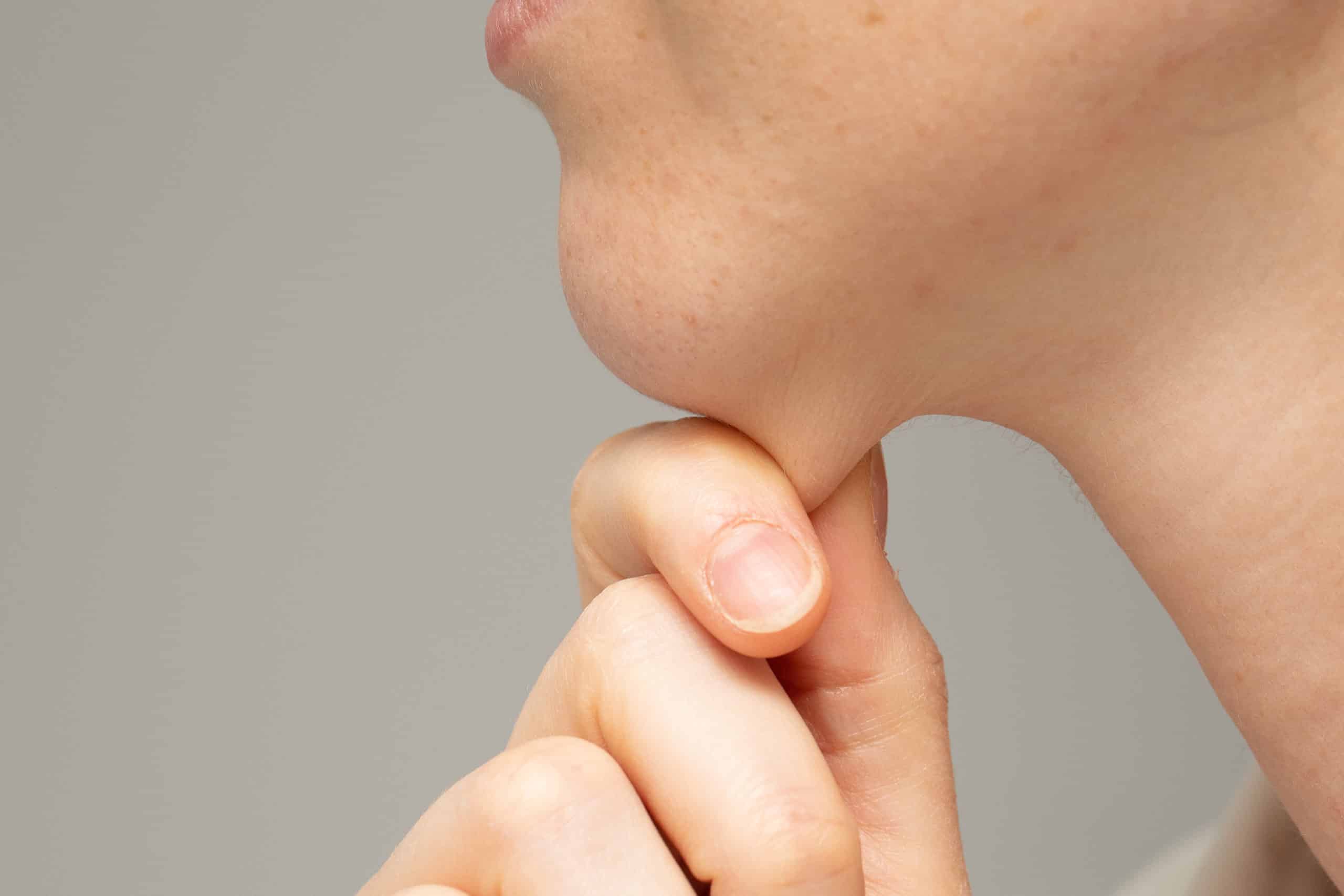 Saggy Neck Skin Treatment in Holly Springs, NC | SKYNN MD