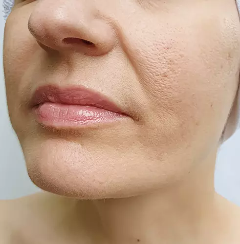 before a close-up of a woman's face in Holly Springs, NC