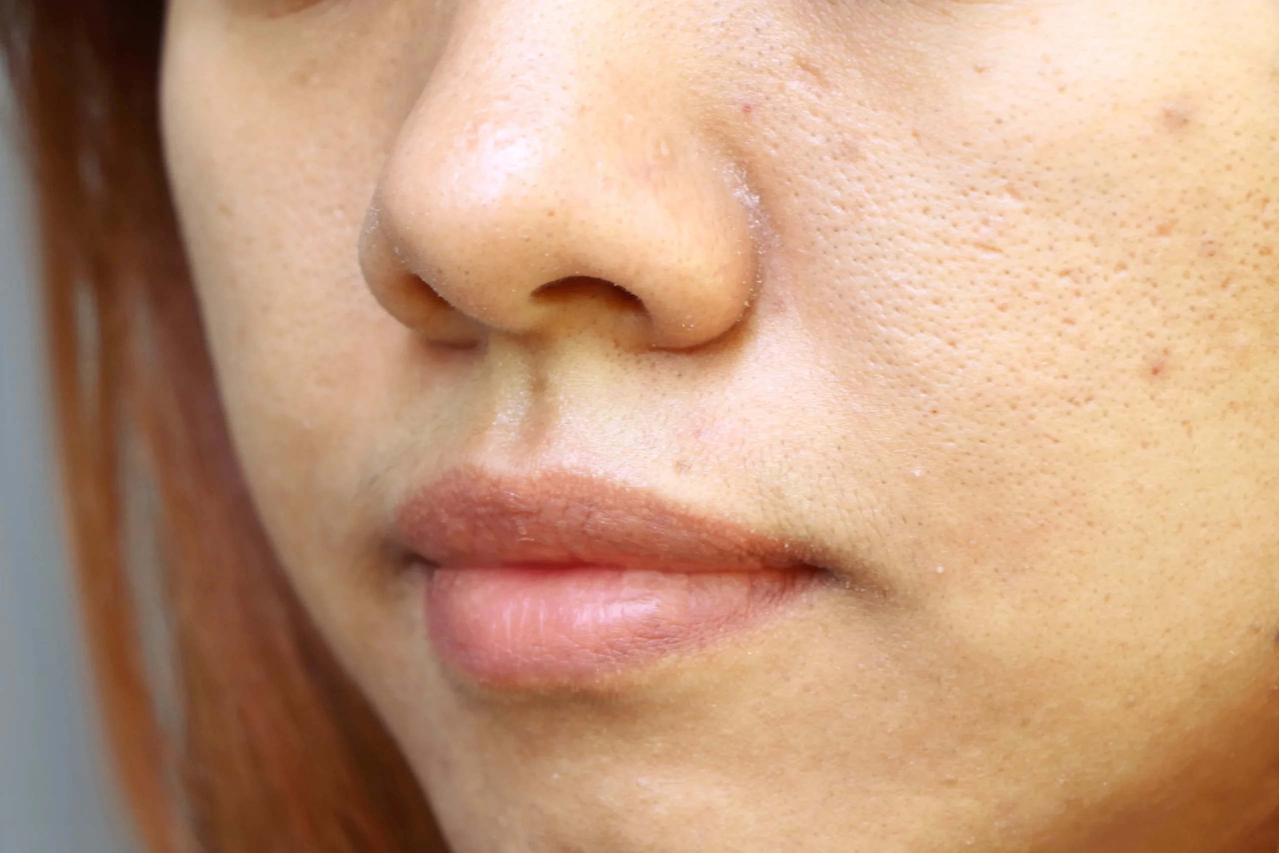 A close-up of a woman's face, minimizing the appearance of large pores in Holly Springs, NC
