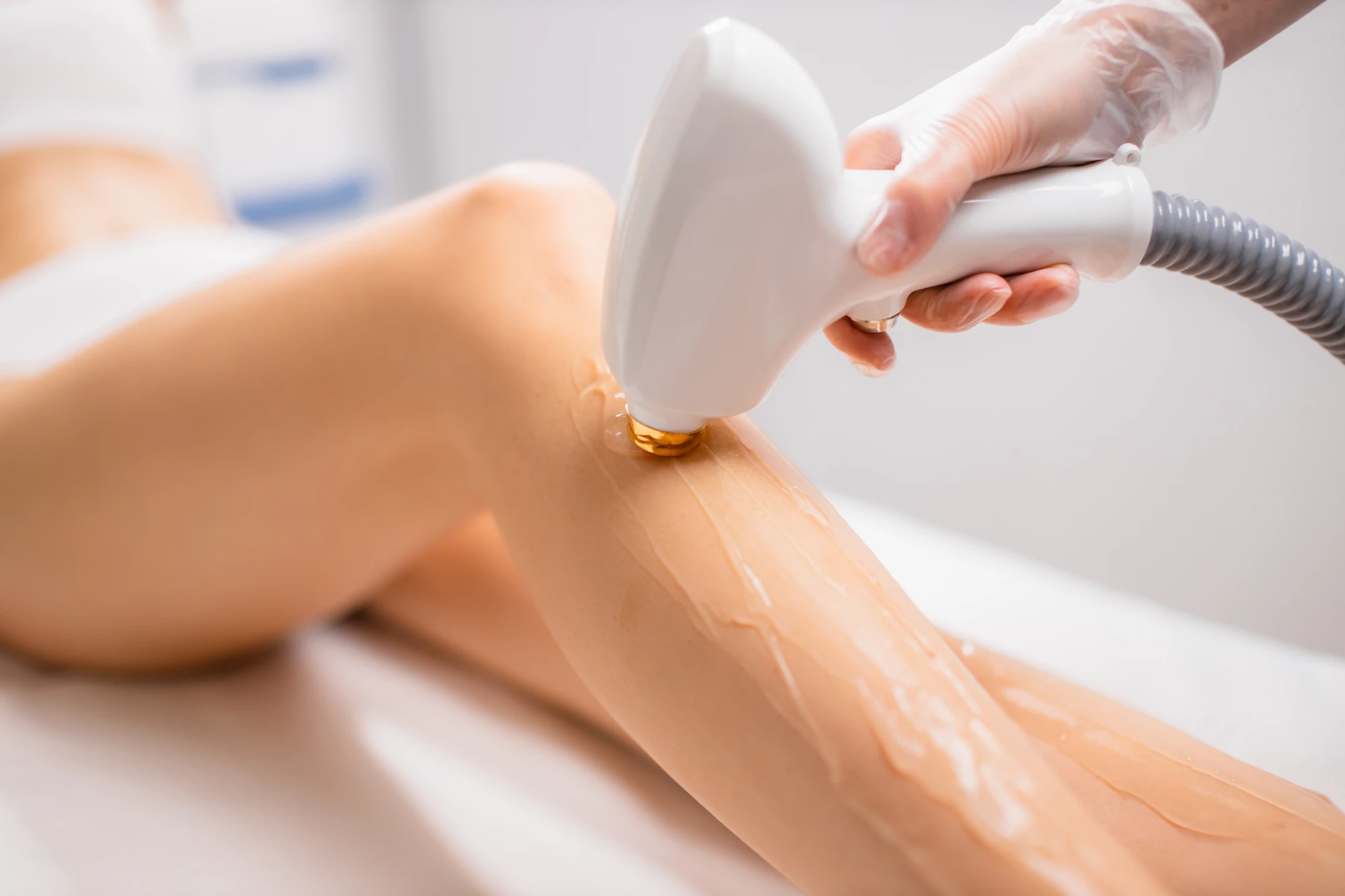 a person receiving a laser epilation procedure, Laser Hair Removal for Legs in Holly Springs, NC
